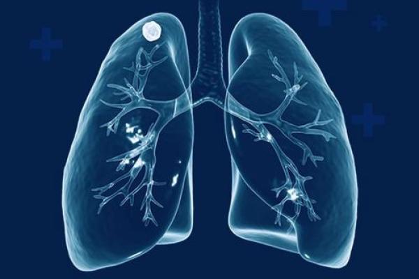 3月24日是什么日子? 3月24日世界防治结核病日 3月24日是什么日子? 3月24日世界防治结核病日